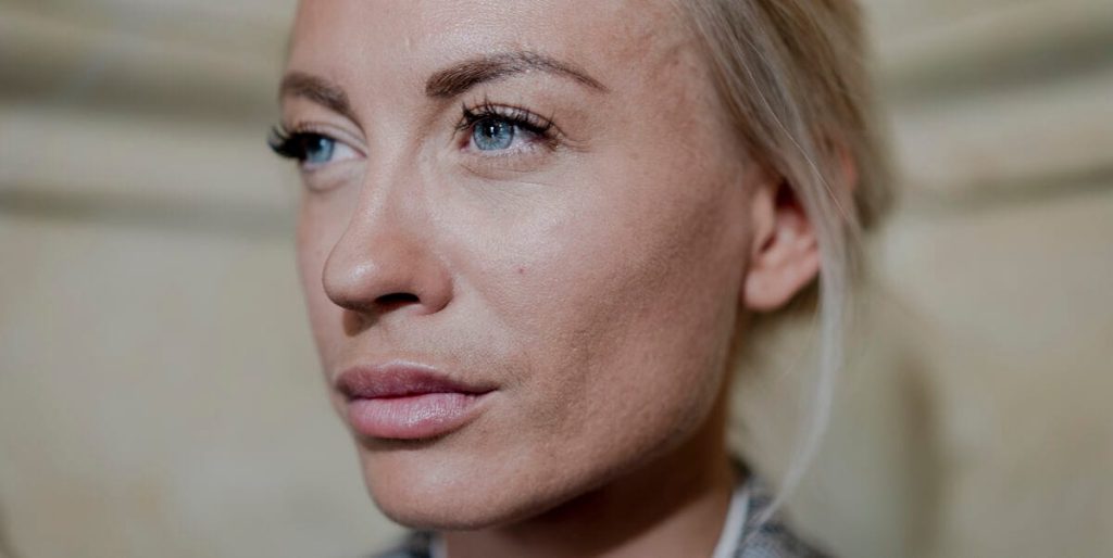 Vækker opsigt i udlandet: Katherine Diez i skandalens spotlight igen