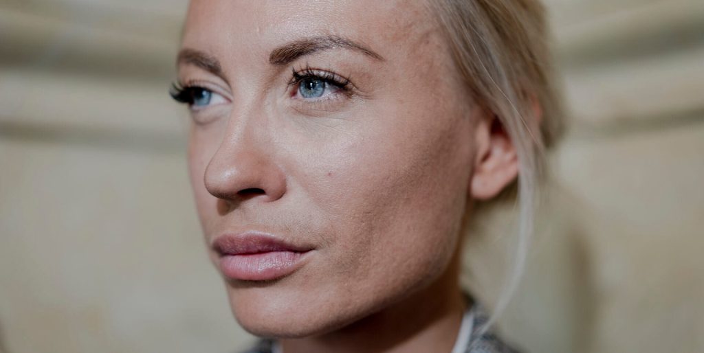 Efter mediestorm: Katherine Diez går til modangreb med hudløst ærligt opslag