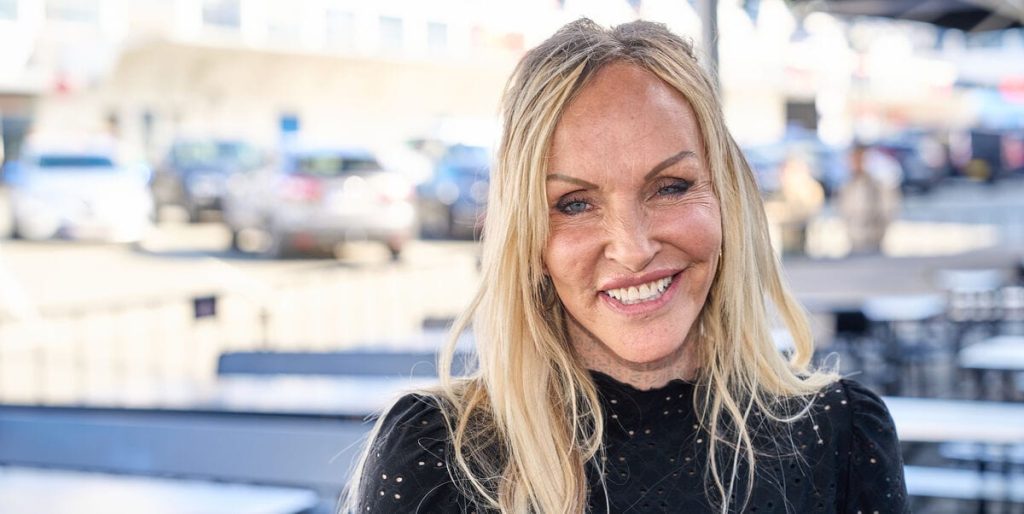 Det var Linses Kesslers ærkefjende: Men så ændrede dette alt