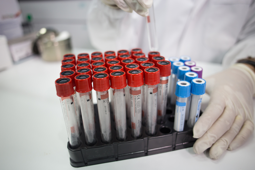 Bioanalytiker løn